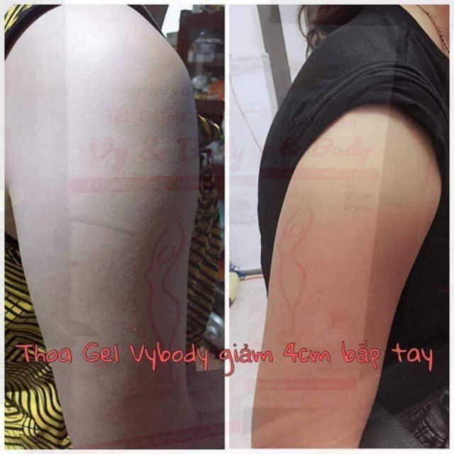 KEM MASSAGE TAN MỠ BỤNG VY&BODY