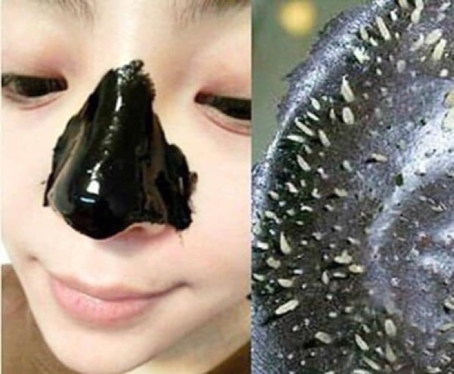 Mặt nạ lột mụn đầu đen MISTINE Blackhead