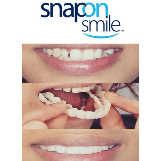 Sale Răng giả Snap on smile