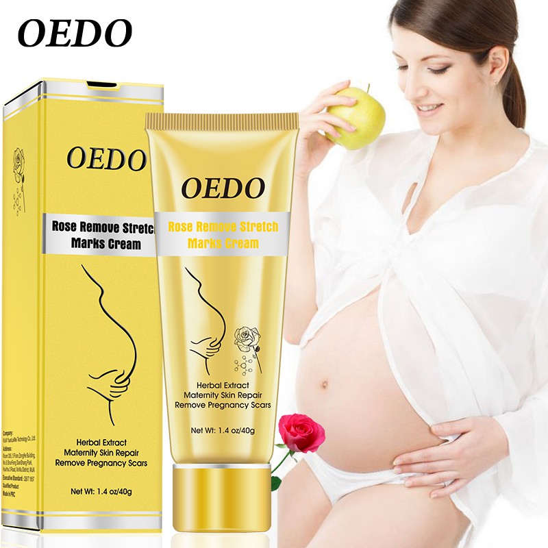 OEDO Rose Remove Stretch Marks Cream 40g | BigBuy360 - bigbuy360.vn