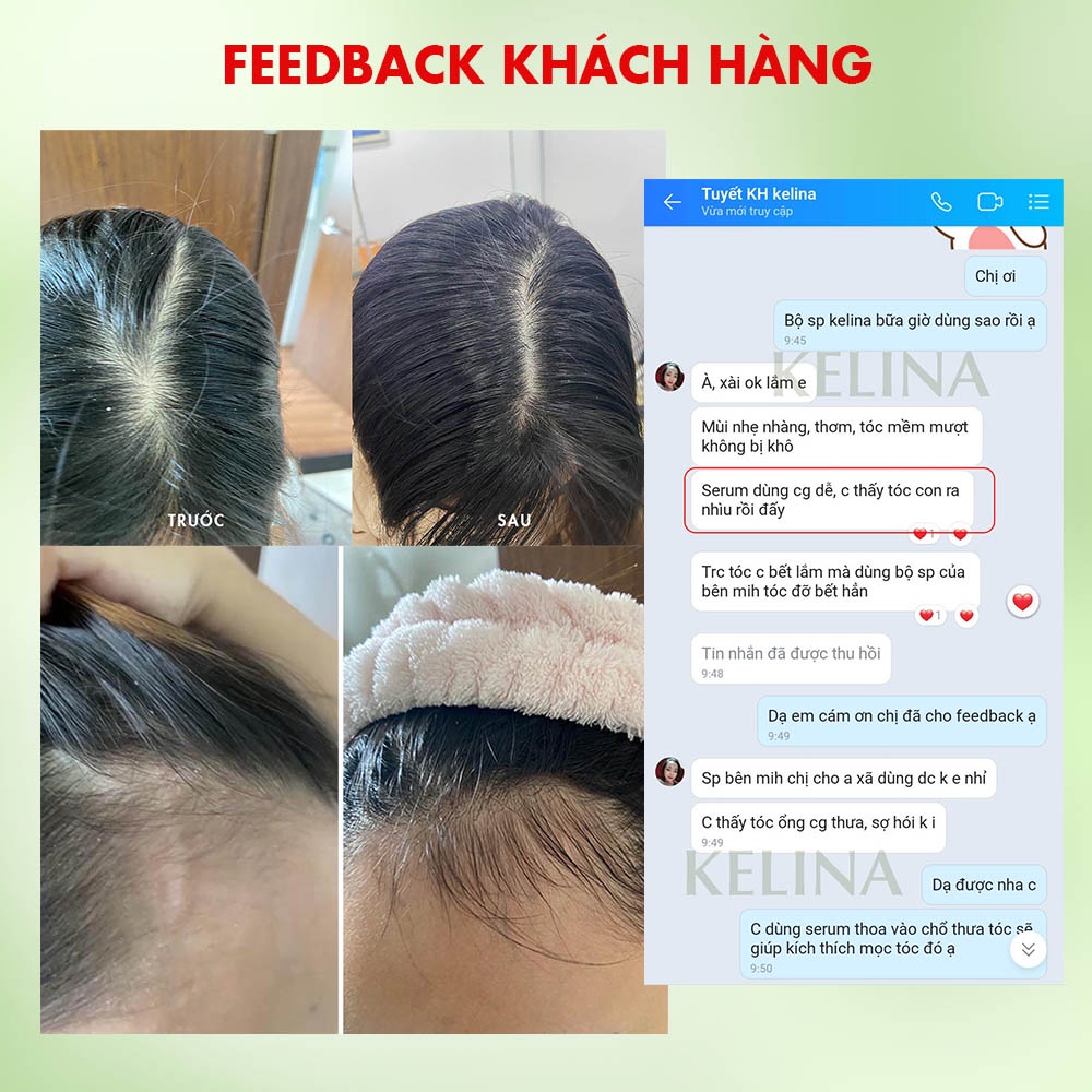 Dầu Gội Ngăn Rụng Tóc Kelina Từ Thảo Dược Làm Sạch Sâu, Giảm Gàu Ngứa, Ngăn Bết Tóc, Kích Thích Mọc Tóc 300ml