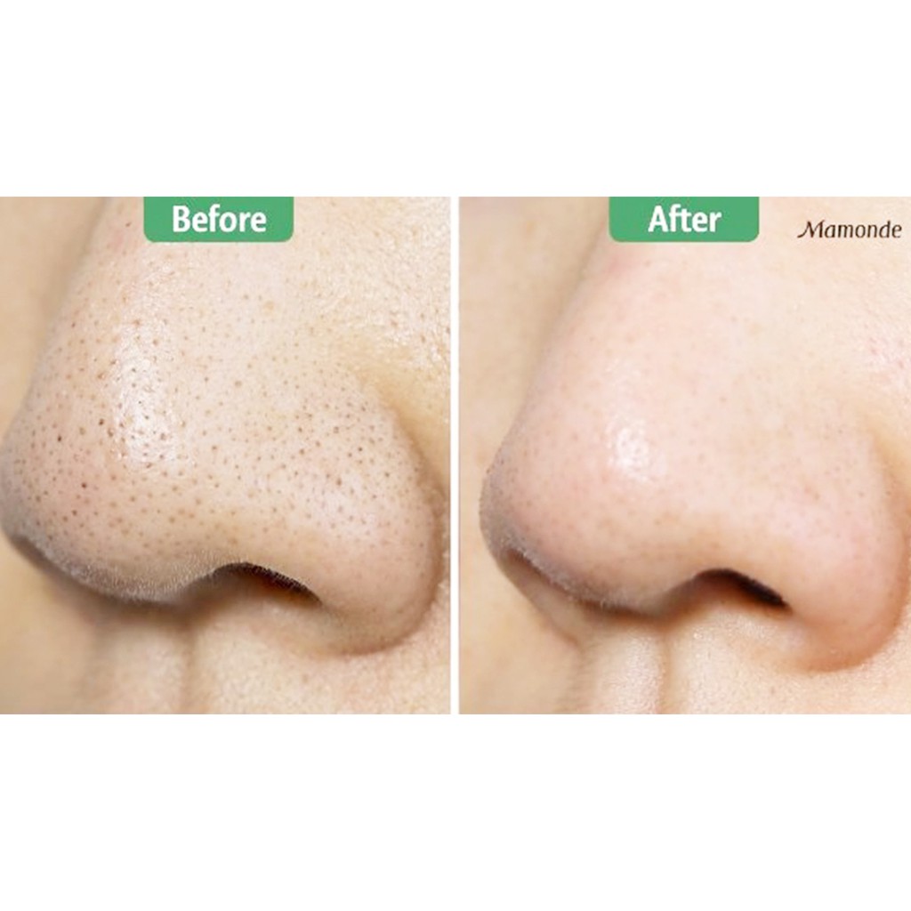 Thanh lăn mụn Mamonde - Thanh sáp lăn mụn đầu đen ngừa mụn thu nhỏ lỗ chân lông Mamonde Pore Clean Stick 18g | BigBuy360 - bigbuy360.vn