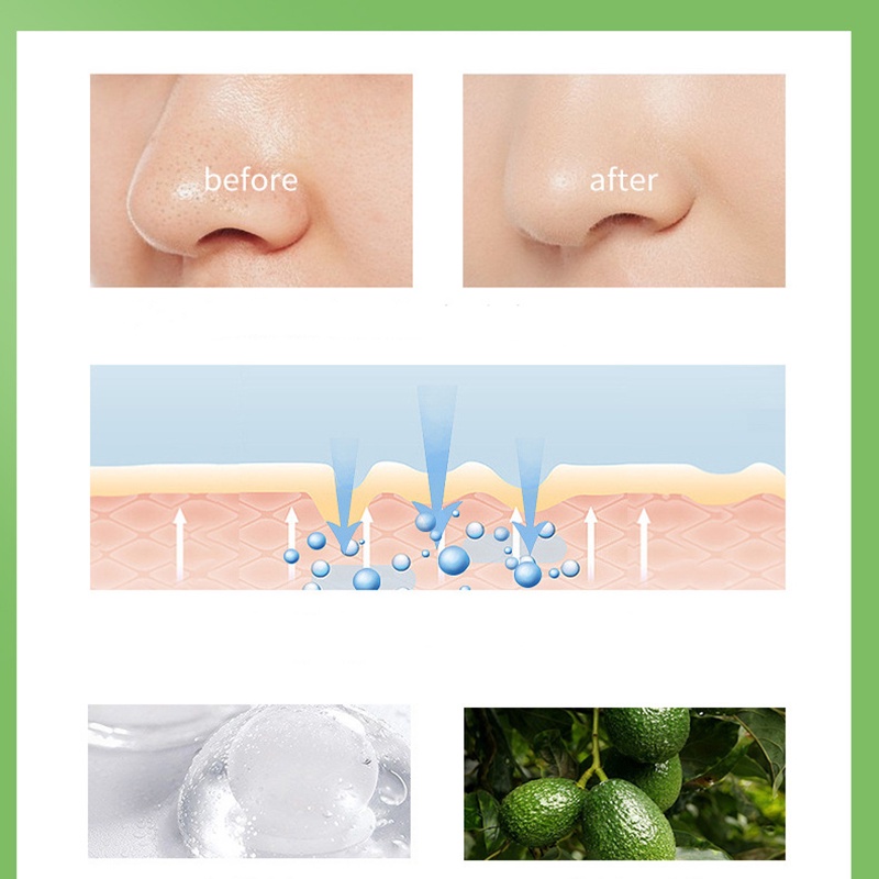 Sáp tẩy trang quả bơ QISE Avocado Purifying Cleansing Balm làm sạch sâu dịu nhẹ dưỡng ẩm sáng da
