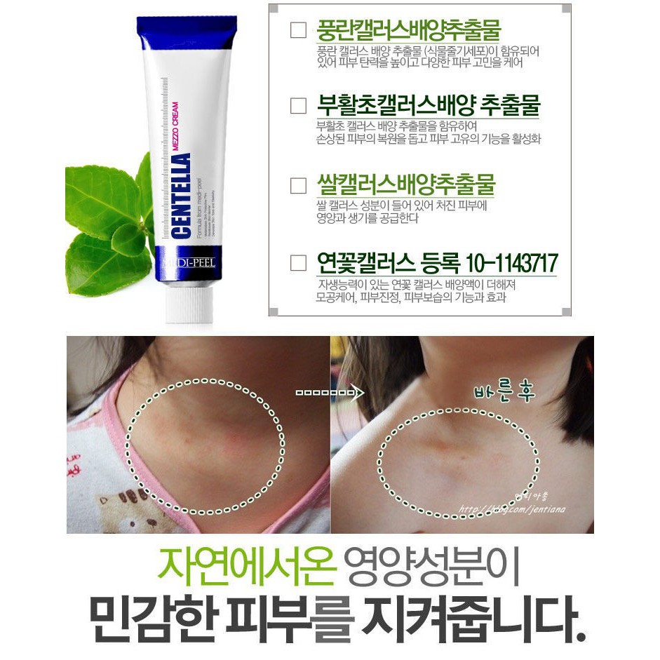 Kem Rau Má Hỗ Trợ Giảm Mụn Phục Hồi Da MEDI PEEL CENTELLA MEZZO CREAM (Tuýp xanh dương)