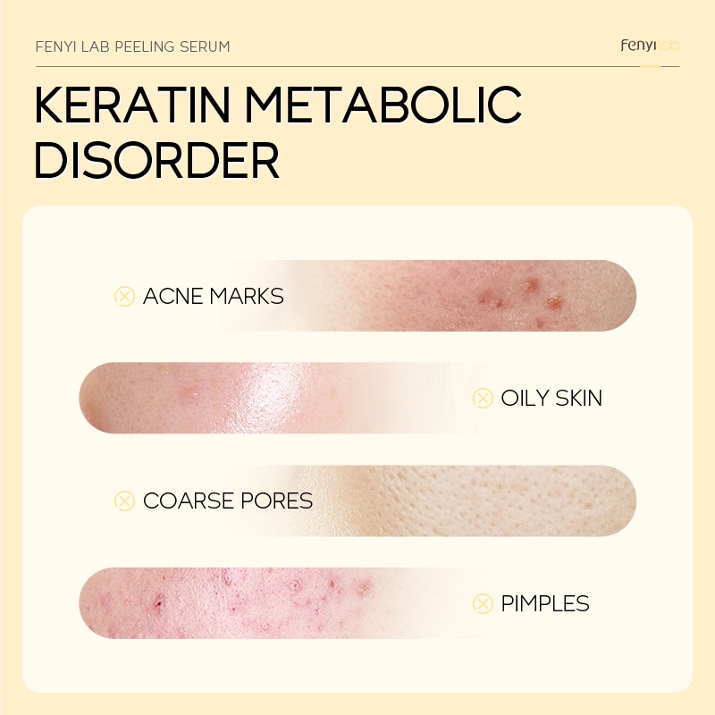 Serum Dạng Lột FENYI lab Làm Sạch Lỗ Chân Lông Làm Sáng Da Mặt 17