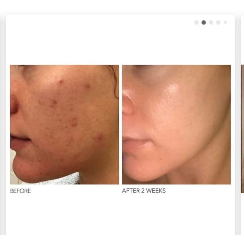 [ xả lỗ date 2026]  Dr Dennis Gross alpha beta peel tẩy da chết sét 2 gói | BigBuy360 - bigbuy360.vn