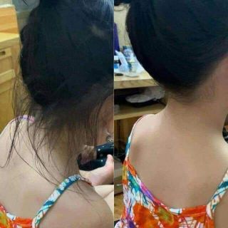 Chuốt tóc con. Chuốt tóc tơ
