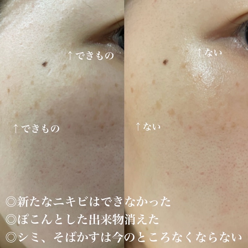 Melano CC Premium tinh chất mờ thâm mờ nám