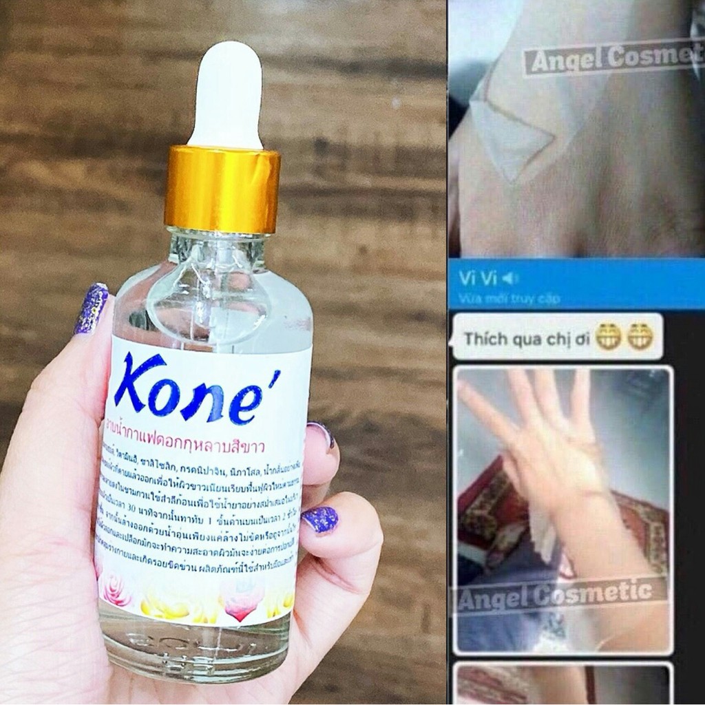 Nước lột kone’ ( cam kết chính hãng)
