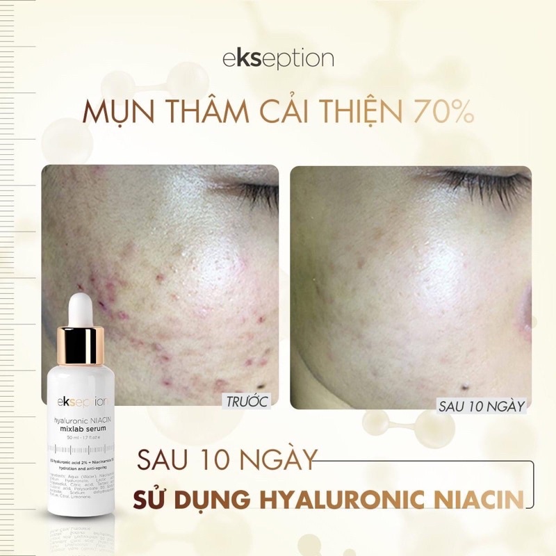 Serum làm sáng và đều màu da Ekseption Hyaluronic TRX 50ml