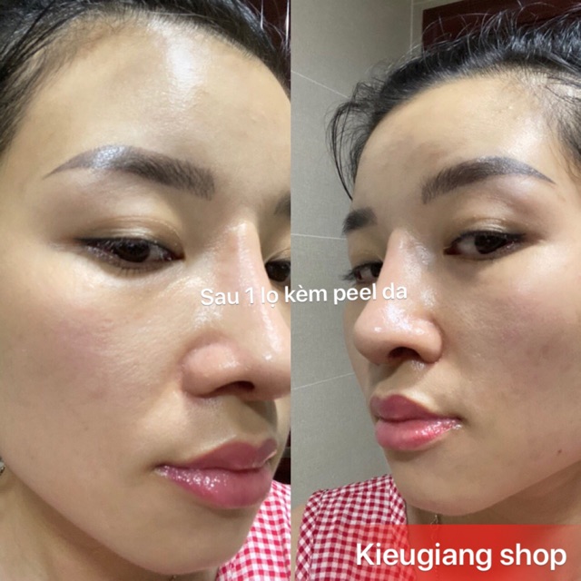 Serum caramel essence( 1 tuần dùng không hiệu quả được đổi trả hoàn tiền) | BigBuy360 - bigbuy360.vn