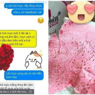 Bộ Lột Mụn MWhite