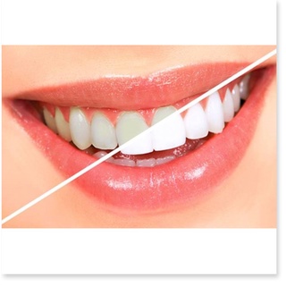 Bột Nở Arm & Hammer Pure Baking Soda