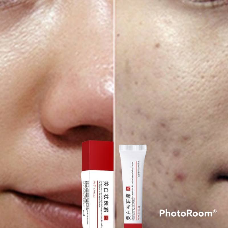 Kem giảm thâm mụn, làm mờ vết thâm, cải thiện sắc tố da Zuzu Cosmetic