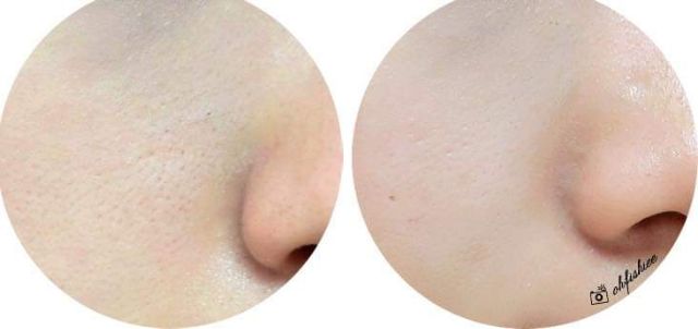 [5ML]Serum se khít lỗ chân lông Kiehl's Precision | BigBuy360 - bigbuy360.vn