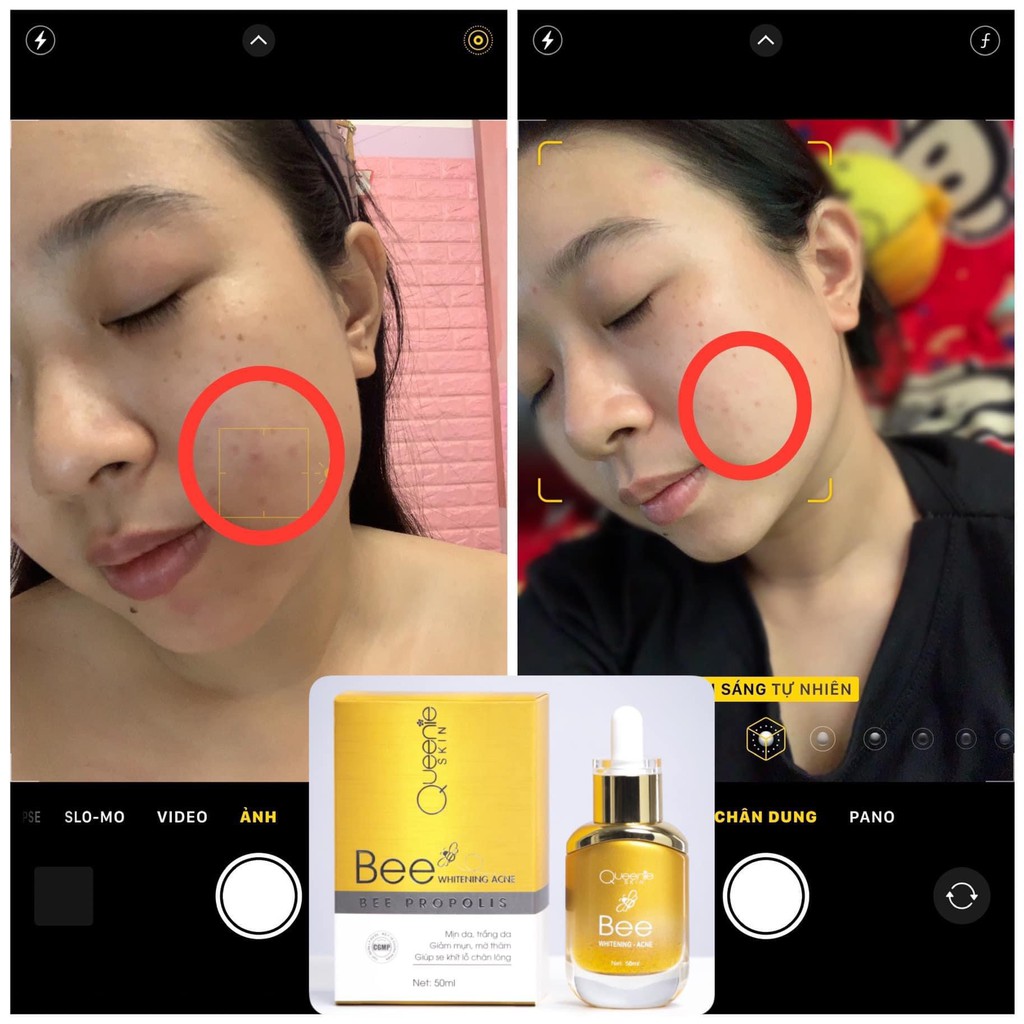 GEL MỤN KEO ONG | BigBuy360 - bigbuy360.vn