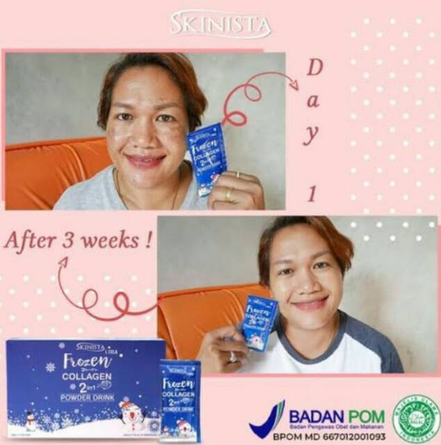 (hàng Mới Về) Bột Collagen 2 Trong 1 Skinista Frozen