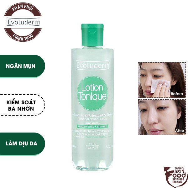 Nước Hoa Hồng Dành Cho Da Hỗn Hợp, Nhờn Mụn Evoluderm Lotion Tonique Peaux Mixtes A Grasses 250ml