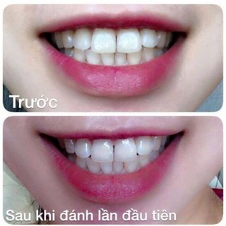 Bột đánh trắng răng Eucryl Toothpowder 50g