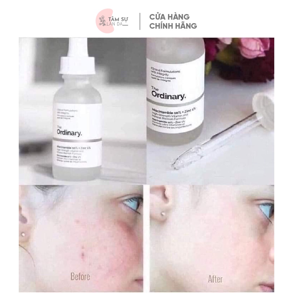 Serum The Ordinary Niacinamide 10% + Zinc 1% Giúp Cân Bằng Bã Nhờn Làm Sáng Da Thu Nhỏ Lỗ Chân Lông 30ml