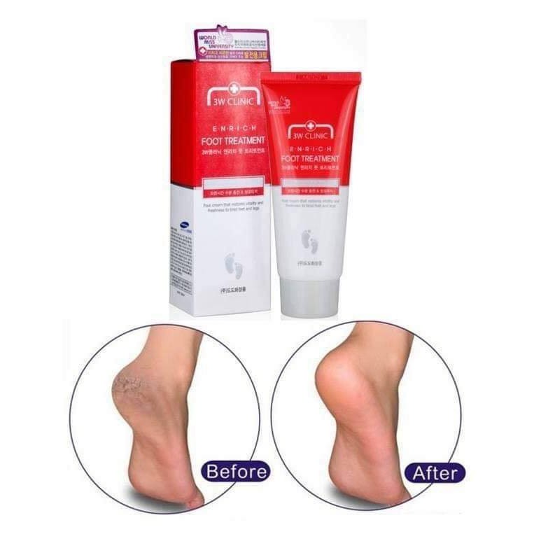 Kem làm giảm nứt gót chân 3W Clinic 100g từ Hàn Quốc