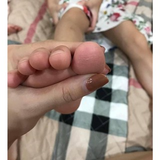 Kem Đông Y Á Sừng