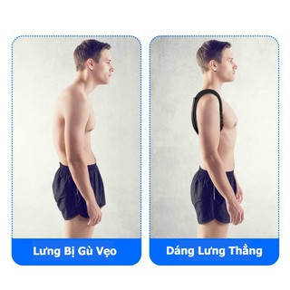 ĐAI CHỐNG GÙ LƯNG