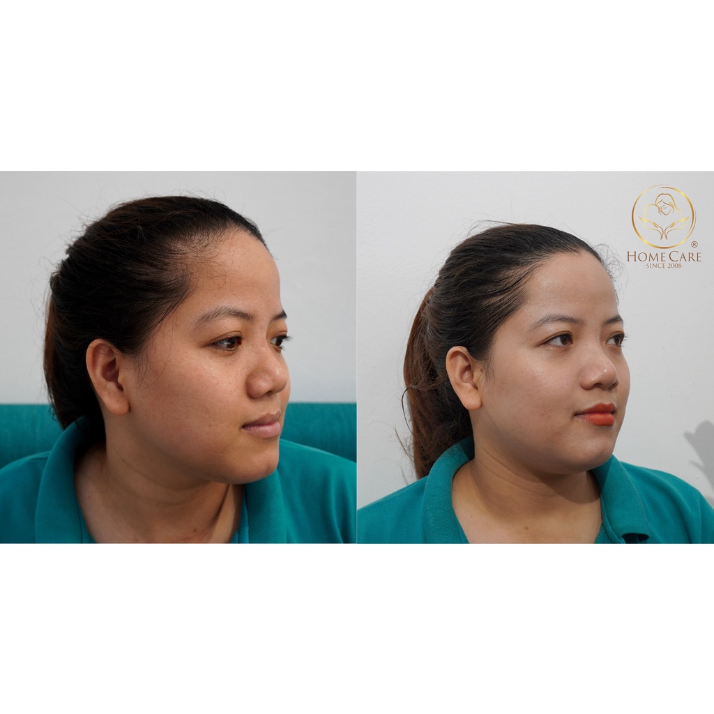 Kem ủ trắng face Phục linh nâng tone tự nhiên