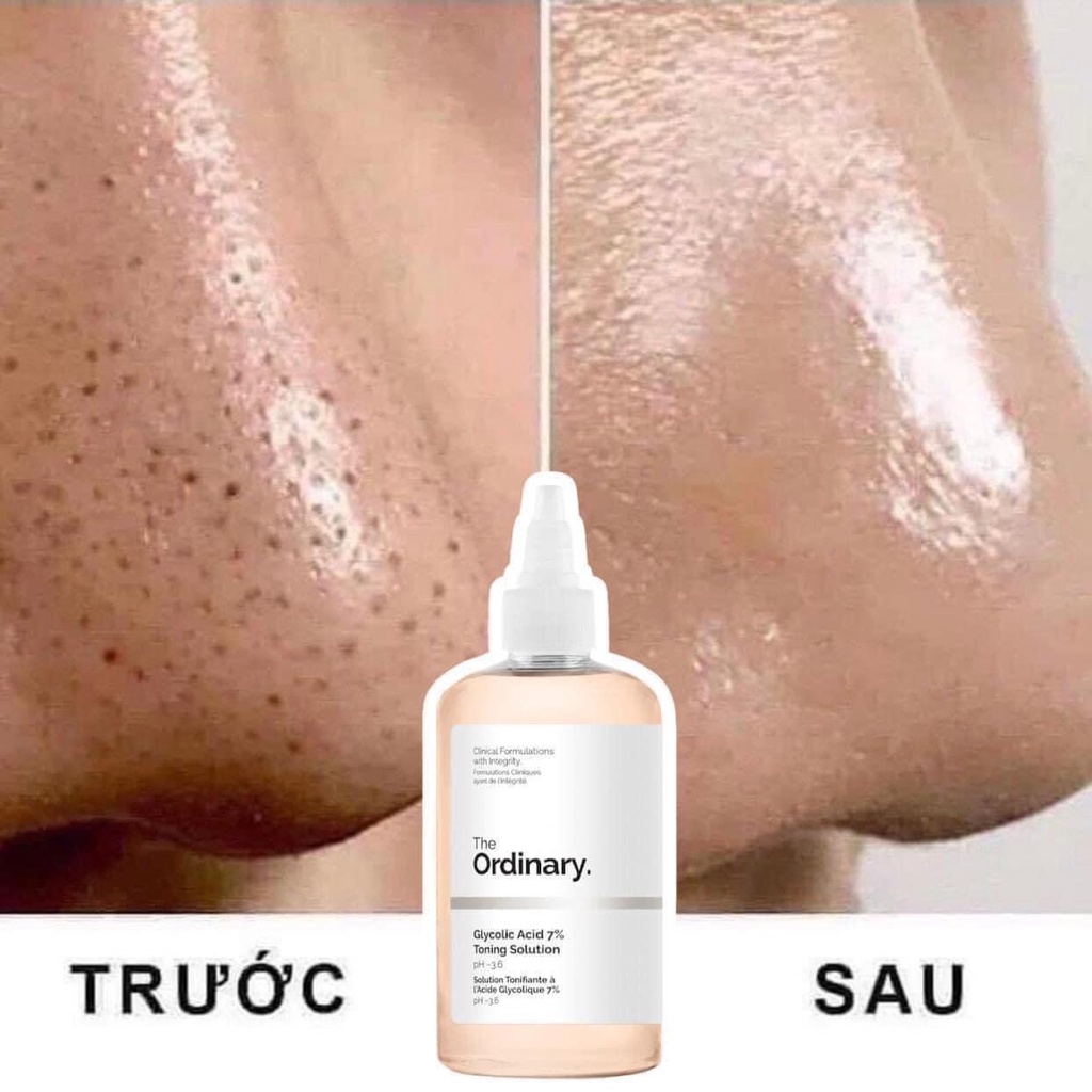 Toner tẩy da chết làm sạch The Ordinary Glycolic Acid 7% Toning Solution