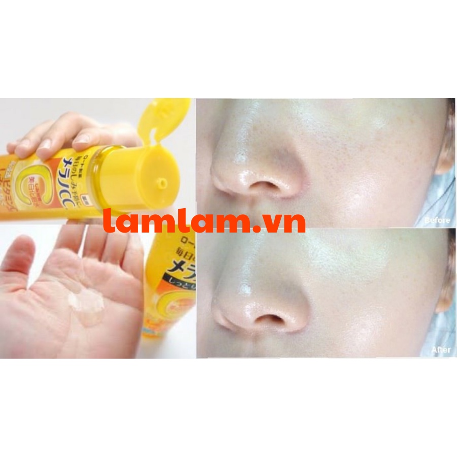 Nước hoa hồng Vitamin C - Rohto Melano CC Anti-Spot White Lotion 170ml