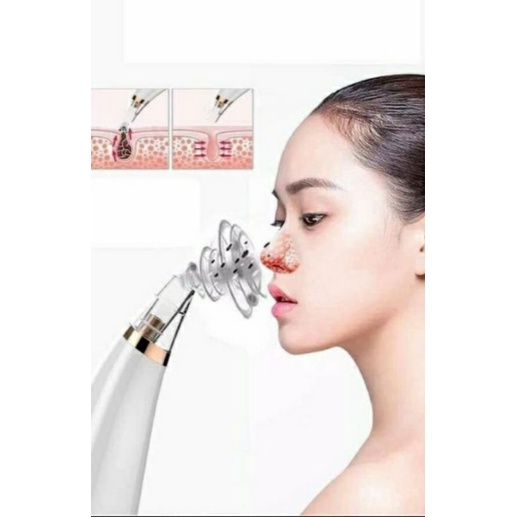 Máy hút mụn đầu đen mẫu mới - giải pháp tối ưu cho mọi loại da sạch sẽ và săn chắc