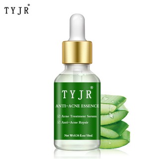 Tinh chất lô hội - loại bỏ mụn, thu nhỏ lỗ chân lông - Serum TYJR Anti Acne Essence