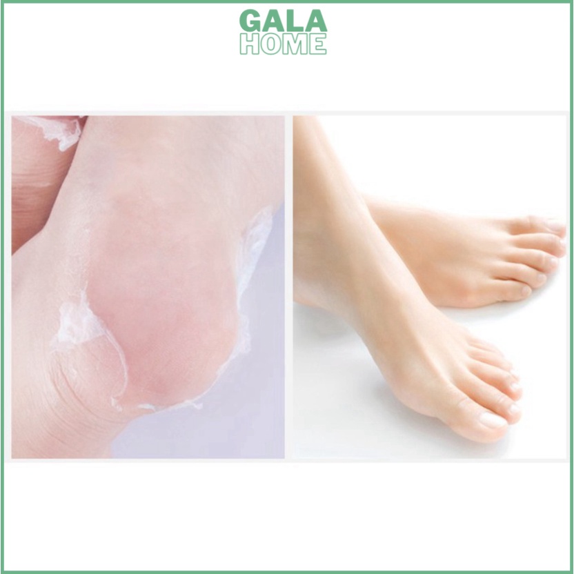 Mặt nạ chân giúp cho đôi chân mềm mại, trắng sáng hiệu quả trong 2-7 ngày GALA HOME