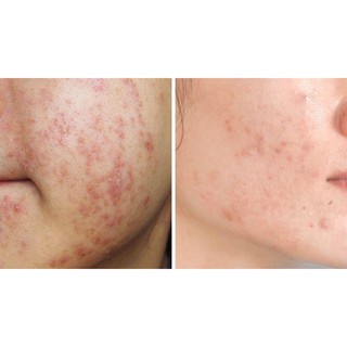 SERUM B5 GOODNDOC CHÍNH HÃNG dưỡng ẩm trắng da 30ml | BigBuy360 - bigbuy360.vn