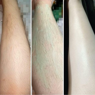 Kem Triệt Lông Iwax
