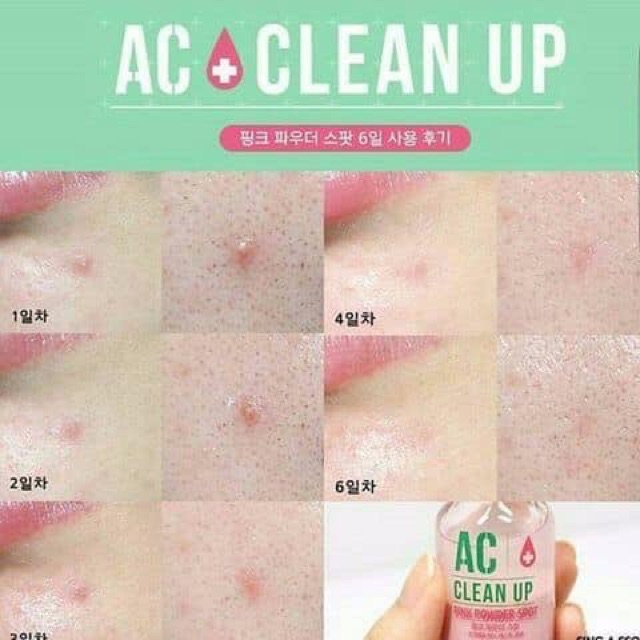 [Mẫu mới] Chấm mụn AC CLEAN UP PINK POWDER SPOT | BigBuy360 - bigbuy360.vn