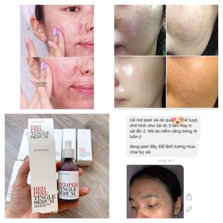 TINH CHẤT RED PEEL TINGLE