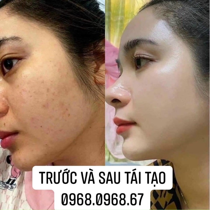 Kem tái tạo chamomileskill