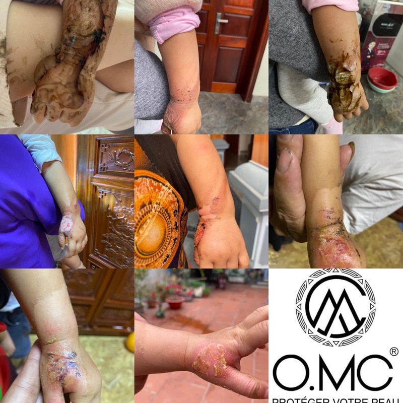 Mặt nạ thải độc phục hồi OMC