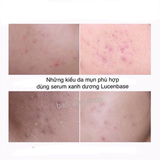 Serum giảm thâm mụn lucenbase