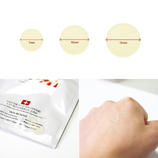 Miếng Dán Mụn Cosrx Acne Pimple Master Patch