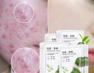 Mặt nạ tràm trà Teatree Removing Acne Mask