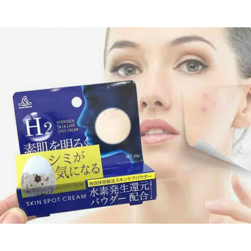 Kem nám H2 skin spot nội địa Nhật
