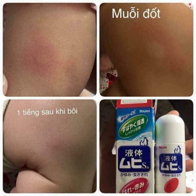 (Date 2025) Lăn muỗi đốt Muhi 50ml Nội địa Nhật