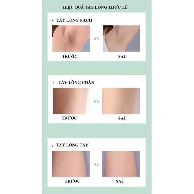Máy triệt lông cầm tay mini, máy triệt lông tay, lông nách, vùng kín, triệt lông vĩnh viễn