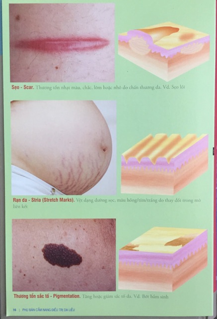 Sách - cẩm nang điều trị da liễu