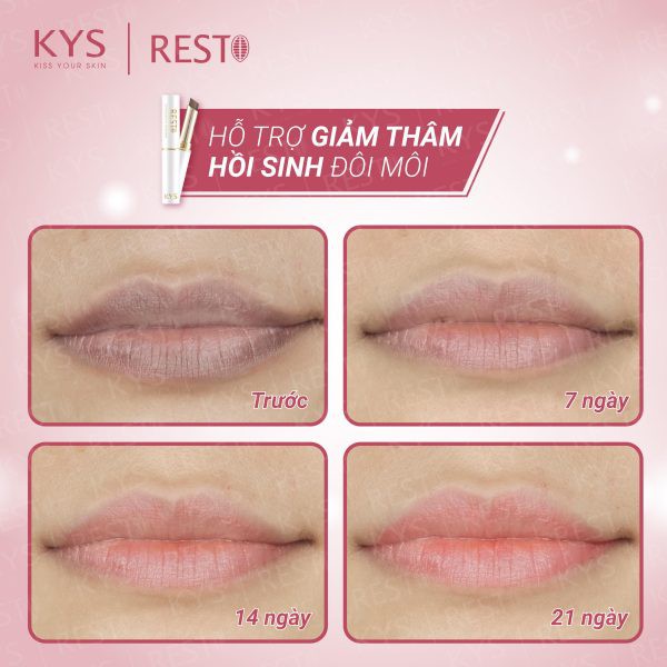Son dưỡng ẩm mềm môi Resto KYS chocolate 1.5G