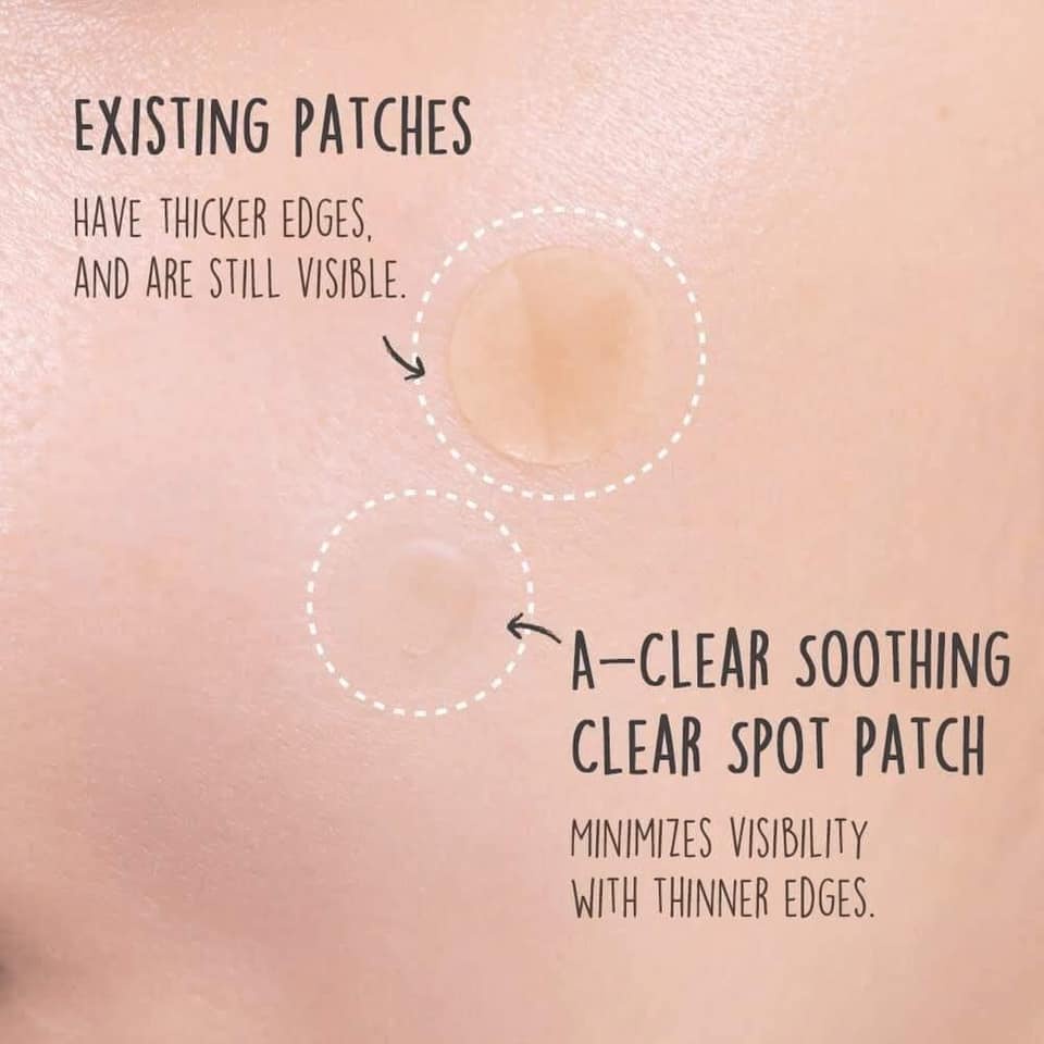 Miếng Dán Mụn Neogen A-Clear Soothing Clear Spot Patch