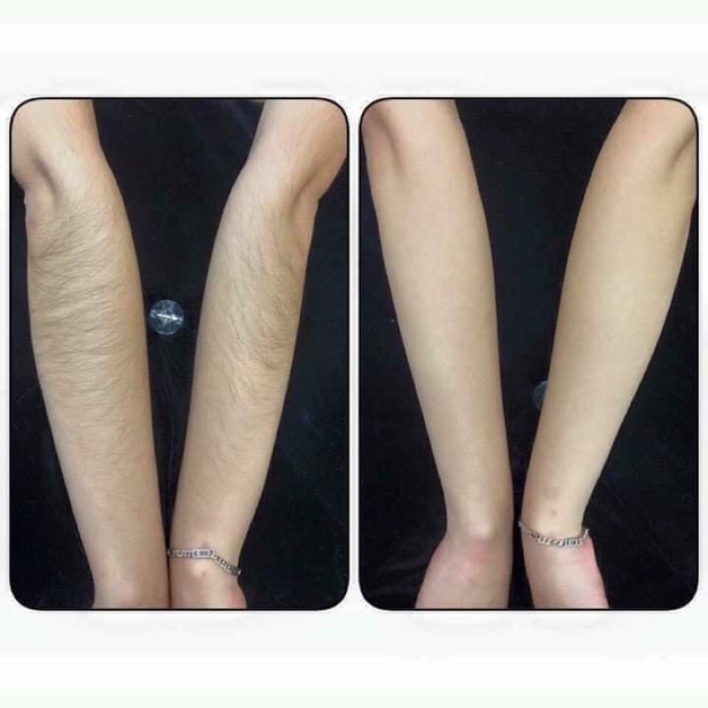  Kem tẩy lông chanh gấc Diamond Skin | BigBuy360 - bigbuy360.vn