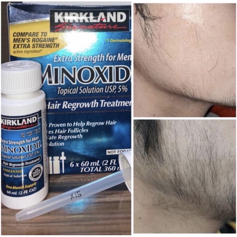 Dung Dịch Mọc Râu Mọc Tóc Kirkland Minoxidil 5% 60ml [1 chai ]